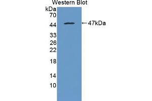Western blot analysis of the recombinant protein. (MTTP Antikörper  (AA 28-459))