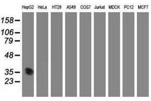 Image no. 3 for anti-Aminoacylase 3 (ACY3) antibody (ABIN1496464) (Aminoacylase 3 Antikörper)
