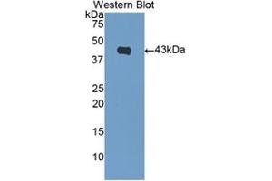 Detection of Recombinant BNP, Human using Polyclonal Antibody to Brain Natriuretic Peptide (BNP) (BNP Antikörper  (AA 27-121))