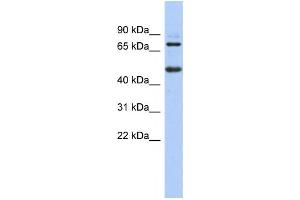Western Blotting (WB) image for anti-Zinc Finger and BTB Domain Containing 26 (ZBTB26) antibody (ABIN2458402) (ZBTB26 Antikörper)