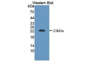 Western blot analysis of the recombinant protein. (ECT2 Antikörper  (AA 453-647))