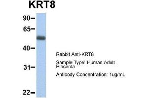 Host:  Rabbit  Target Name:  KRT8  Sample Type:  Human Adult Placenta  Antibody Dilution:  1. (KRT8 Antikörper  (Middle Region))