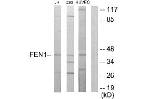Immunohistochemistry analysis of paraffin-embedded human breast carcinoma tissue using FEN1 antibody. (FEN1 Antikörper)