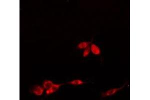 ABIN6275756 staining  HuvEC cells by IF/ICC. (SLC30A9 Antikörper  (Internal Region))