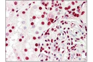 Immunohistochemistry (Paraffin-embedded Sections) (IHC (p)) image for anti-X-Ray Repair Complementing Defective Repair in Chinese Hamster Cells 5 (Double-Strand-Break Rejoining) (XRCC5) (C-Term) antibody (ABIN1449670)