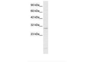 Image no. 2 for anti-RNA-binding protein Raly (RALY) (N-Term) antibody (ABIN6735882)