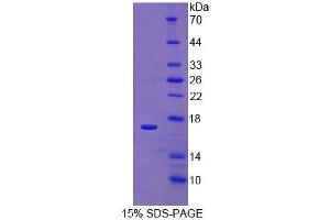 Image no. 1 for RalA Binding Protein 1 (RALBP1) (AA 192-380) protein (His tag) (ABIN1171249) (RALBP1 Protein (AA 192-380) (His tag))