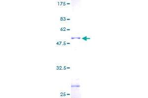 Image no. 1 for Zinc Finger Protein 22 (ZNF22) (AA 1-224) protein (GST tag) (ABIN1325989)