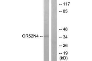 Western blot analysis of extracts from HeLa cells, using OR52N4 Antibody. (OR52N4 Antikörper  (AA 272-321))