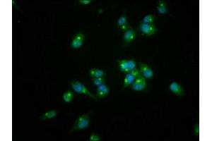 Immunofluorescence staining of SH-SY5Y cells with ABIN7167554 at 1:166, counter-stained with DAPI. (REG3A Antikörper  (AA 27-175))