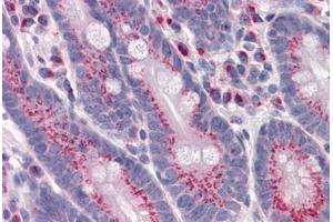 Human Small intestine: Formalin-Fixed, Paraffin-Embedded (FFPE) (GPR3 Antikörper  (AA 1-331))