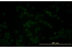 Immunofluorescence of monoclonal antibody to FOLH1 on K-562 cell . (PSMA Antikörper  (AA 1-719))
