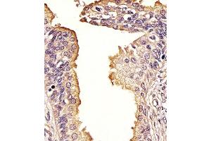 (ABIN388979 and ABIN2850435) staining SQSTM1 in Human prostate tissue sections by Immunohistochemistry (IHC-P - paraformaldehyde-fixed, paraffin-embedded sections). (SQSTM1 Antikörper  (AA 317-346))