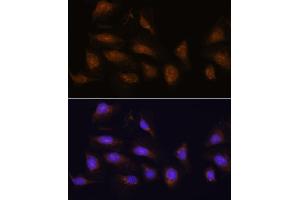 Immunofluorescence analysis of U-2 OS cells using RPS6K antibody (5718) at dilution of 1:100. (RPS6KA1 Antikörper  (C-Term))