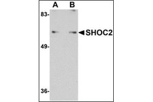Western blot analysis of SHOC2 in Jurkat cell lysate with this product at (A) 1 and (B) 2 μg/ml. (SHoc2/Sur8 Antikörper  (N-Term))