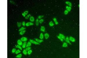 Figure:FITC staining on IHC-P;Simple: Hela cells (HCCS Antikörper  (AA 1-268))