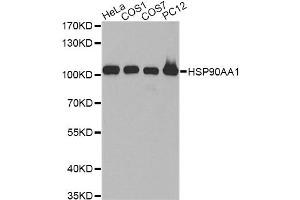Western blot analysis of extracts of various cell lines, using HSP90AA1 antibody. (HSP90AA1 Antikörper)