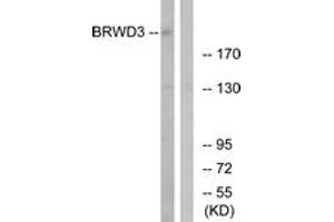 Western blot analysis of extracts from COLO cells, using BRWD3 Antibody. (BRWD3 Antikörper  (AA 1751-1800))
