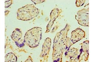 Immunohistochemistry of paraffin-embedded human placenta tissue using ABIN7156743 at dilution of 1:100 (IL1R1 Antikörper  (AA 18-320))