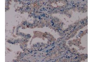 Immunohistochemistry (IHC) image for anti-Nestin (NES) (AA 178-399) antibody (ABIN7426685)