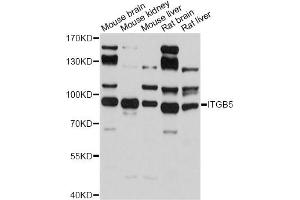Western blot analysis of extracts of various cell lines, using ITGB5 antibody (ABIN5971332) at 1/500 dilution.