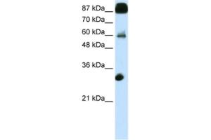 Western Blotting (WB) image for anti-CCCTC-Binding Factor (Zinc Finger Protein) (CTCF) antibody (ABIN2461796) (CTCF Antikörper)