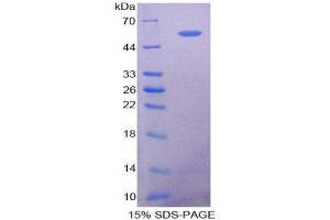 SDS-PAGE (SDS) image for 5'-Nucleotidase, Ecto (CD73) (NT5E) protein (ABIN1078680)