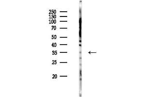 Western blot analysis of lysates from PC12 cells(UV 30 min treatment), using OR6C70 Antibody at 1/1000 dilution.