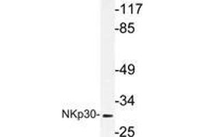 Western blot (WB) analysis of NKp30 antibody in extracts from A549 cells. (NCR3 Antikörper)