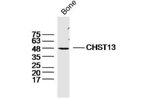 CHST13 Antikörper  (AA 151-250)