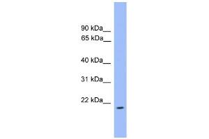 WB Suggested Anti-ARL3 Antibody Titration: 1.