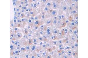 Immunohistochemistry (IHC) image for anti-Glutaryl-CoA Dehydrogenase (GCDH) (AA 270-438) antibody (ABIN5013632)