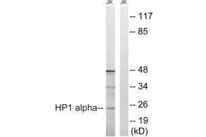 Western blot analysis of extracts from Jurkat cells, treated with insulin (0. (CBX5 Antikörper  (Ser92))