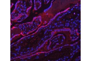 IF analysis of ATP5F1A using anti-ATP5F1A antibody (ABIN7599823). (ATP5F1A (AA 12-520) Antikörper)