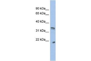 WB Suggested Anti-CDC2  Antibody Titration: 0. (CDK1 Antikörper  (Middle Region))