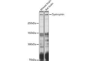 Western blot analysis of extracts of various cell lines, using Dystrophin antibody (ABIN1679546, ABIN3015473, ABIN3015474 and ABIN6218357) at 1:1000 dilution. (Dystrophin Antikörper  (AA 346-635))