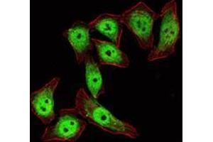 Immunofluorescence analysis of ECA109 cells using KLF4 mouse mAb (green). (KLF4 Antikörper)
