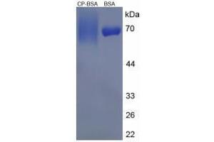 Image no. 1 for C-Peptide peptide (BSA) (ABIN5665948) (C-Peptide peptide (BSA))