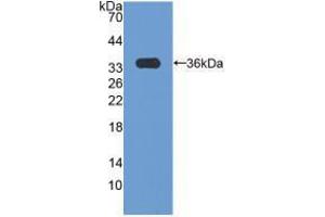 Western blot analysis of recombinant Human CCND3. (Cyclin D3 Antikörper  (AA 1-292))