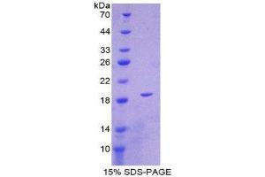 SDS-PAGE (SDS) image for Interleukin 1 delta (FIL1d) (AA 12-151) protein (His tag) (ABIN1980779)