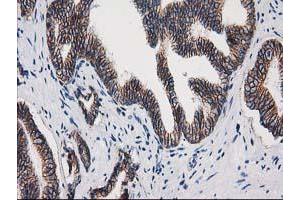 Image no. 4 for anti-Catenin (Cadherin-Associated Protein), beta 1, 88kDa (CTNNB1) antibody (ABIN1496890) (CTNNB1 Antikörper)