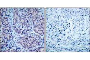 Immunohistochemistry (IHC) image for anti-Histone Deacetylase 2 (HDAC2) (AA 360-409) antibody (ABIN1532886)