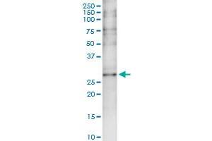 Immunoprecipitation (IP) image for anti-Capping Protein (Actin Filament) Muscle Z-Line, alpha 3 (CAPZA3) (AA 1-299) antibody (ABIN530153)