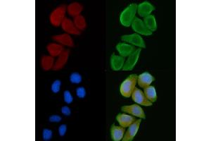 ABIN6260466 and ABIN6272266 staining Hela cells(30 min of UV treatment) by IF/ICC. (CSNK1G1 Antikörper  (C-Term))