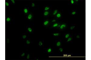 Immunofluorescence of monoclonal antibody to GTF2I on HeLa cell. (GTF2I Antikörper  (AA 36-274))
