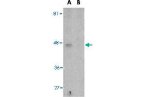 Western blot analysis of APOBEC3G expression in Caco-2 cell lysate in the (A), absence and (B) presence of blocking peptide with APOBEC3G polyclonal antibody  at 5 ug/mL . (APOBEC3G Antikörper  (N-Term))