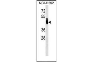 Western blot analysis of PABPC4L Antibody (C-term) in NCI-H292 cell line lysates (35ug/lane).