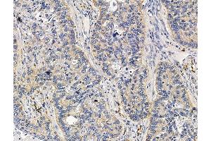 anti-Translocase of Outer Mitochondrial Membrane 5 Homolog (TOMM5) antibody