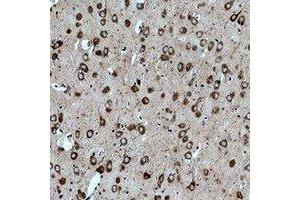 Immunohistochemical analysis of CACNG3 staining in rat brain formalin fixed paraffin embedded tissue section.