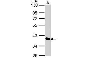 WB Image Sample (30 ug of whole cell lysate) A: A431 , 10% SDS PAGE antibody diluted at 1:1000 (PDLIM4 Antikörper  (C-Term))